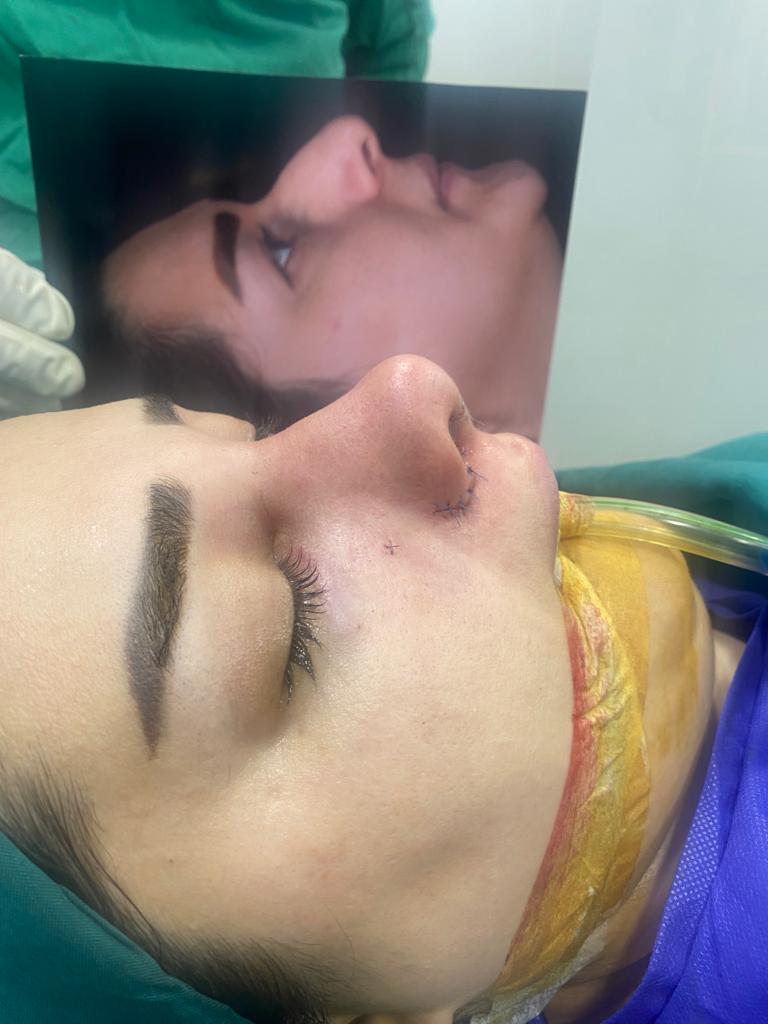 عمل بینی