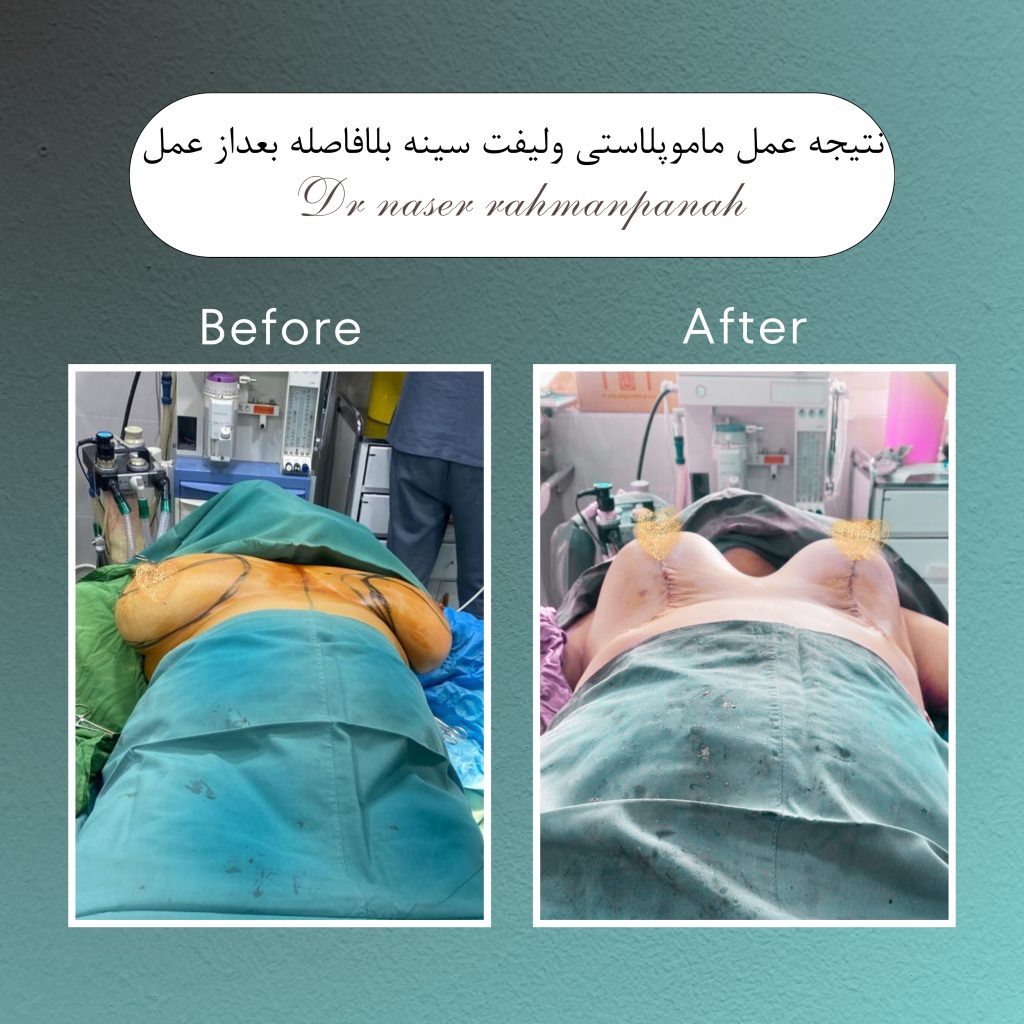 جراحی بادی کانتورینگ